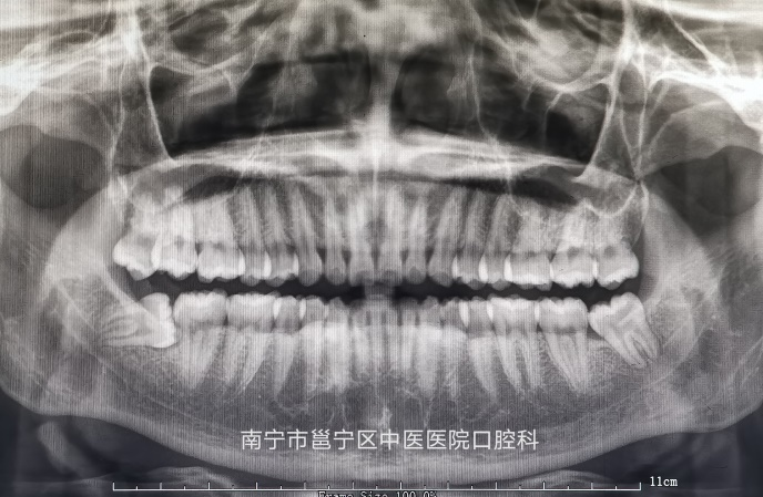 您了解自己的牙齿吗？