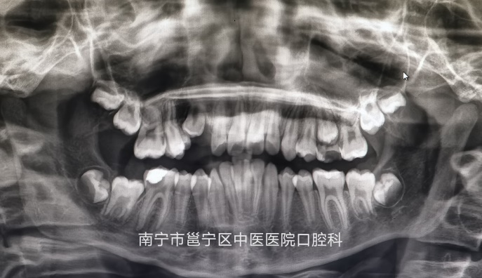 图片12.png 图片12.png