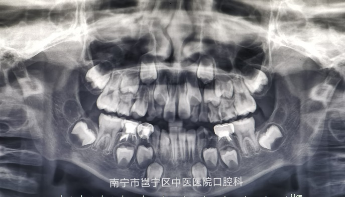 图片13.png 图片13.png